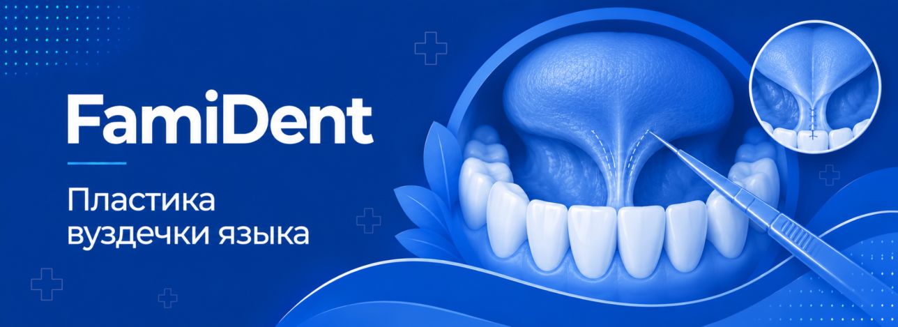 Пластика вуздечки язика стоматолог харків